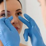 Burun estetiği sonrasında değişen sadece burun mudur?