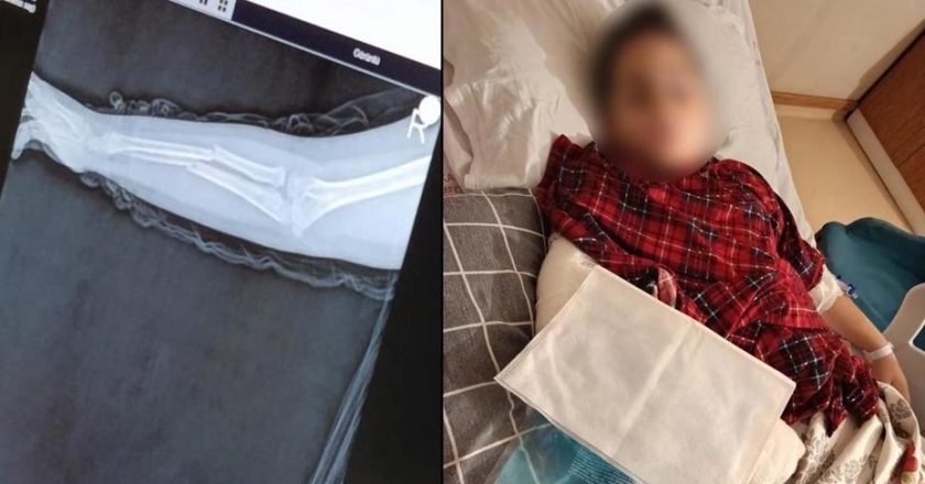 Okulda zorbalık: 9 yaşındaki çocuk arkadaşıyla kavga etti, kolu kırıldı